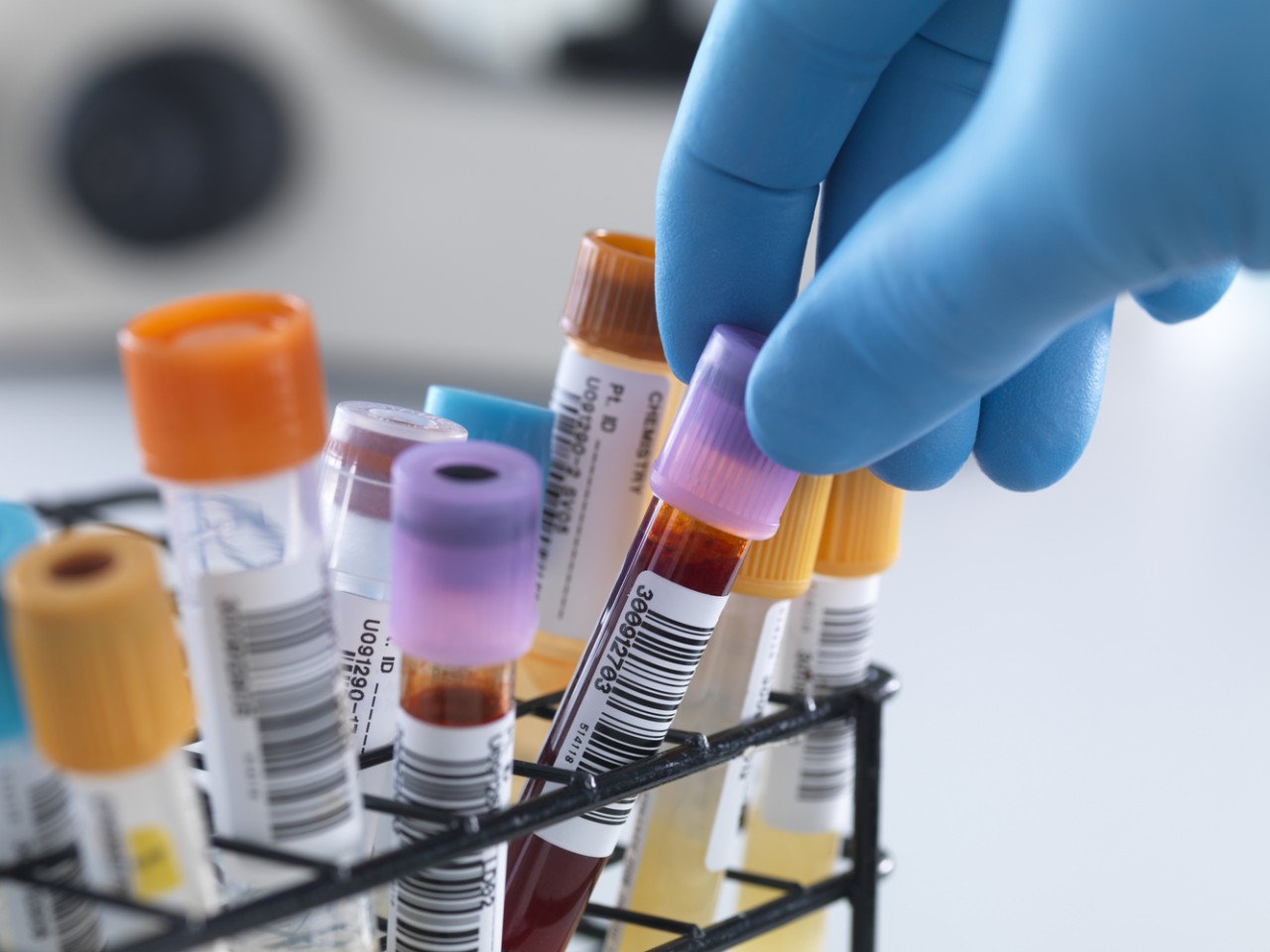 “溶出”照旧“BE”，作甚临床疗效“金标准”