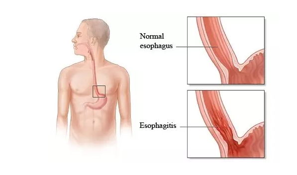 南宫·NG28(China)官方网站-登录入口
