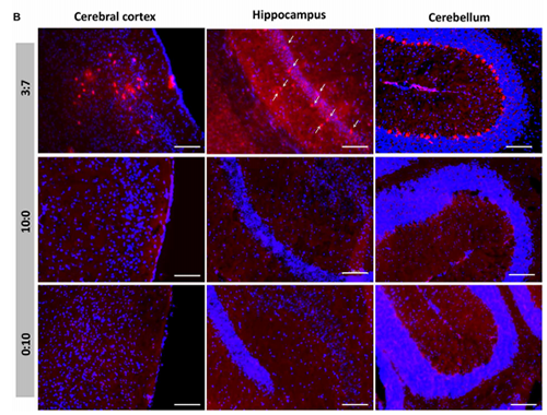 被包裹在含有NT-类脂质的LNP中的Cre重组酶乐成转移。大脑中的转染神经元呈红色高亮。
