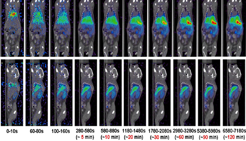 南宫28PET/CT分子影像手艺平台