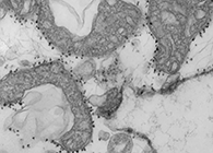 快速血液检测可识别重症高危害COVID-19患者