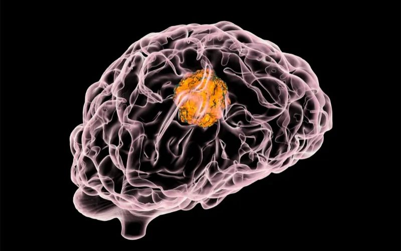 南宫28助力 | 璧辰医药ABM-1310获美国FDA孤儿药资格认证，用于治疗携带BRAF V600突变的脑胶质母细胞瘤患者